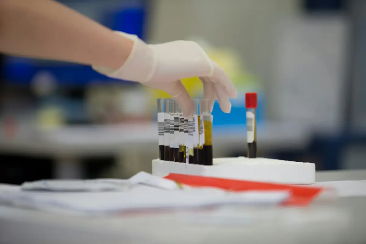 Veterinary laboratory blood samples prepared for a wellness panel