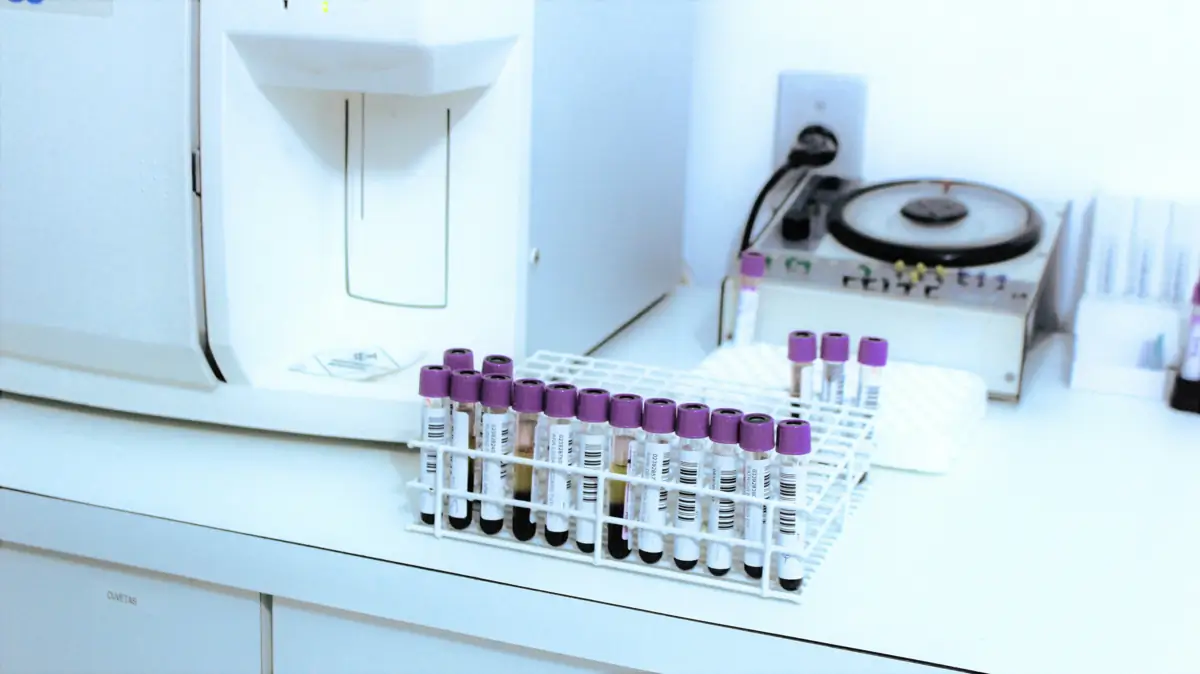 Veterinary laboratory serum samples prepared for endocrinology testing