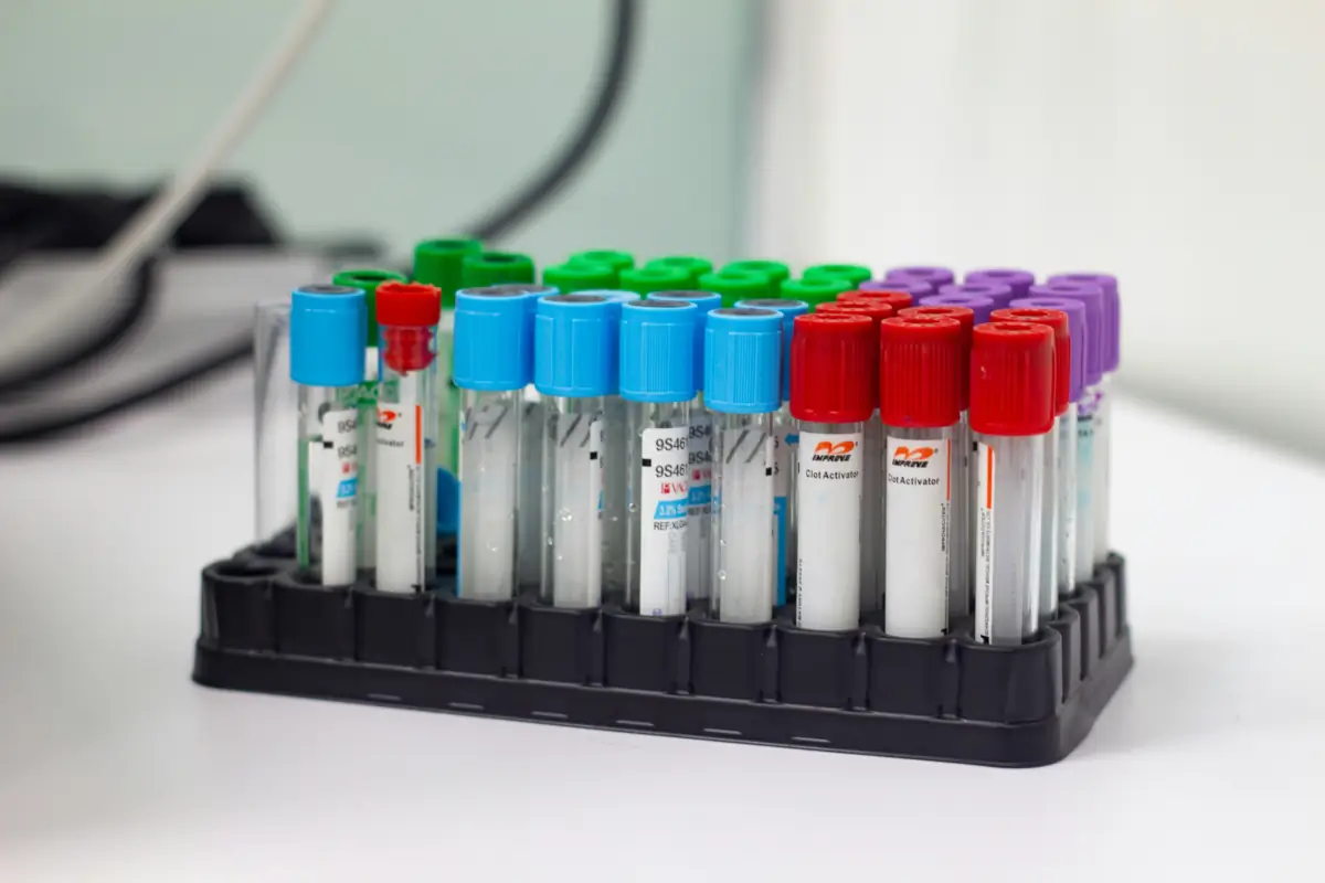 Labeled specimen tubes for veterinary fecal and urine sample testing